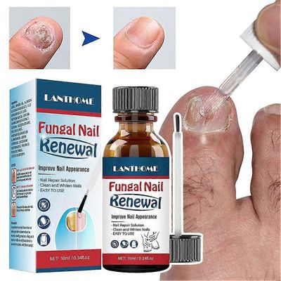 Kynsien korjausratkaisu Nopeasti imeytyvä kynsiä vahvistava neste miehille naisille 3pcs