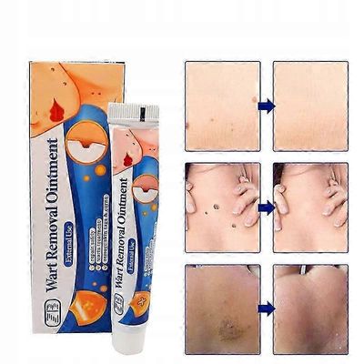 Yrttiuute voide ihon hoitoon – terävät kondyloomat tavalliset syylät herpes