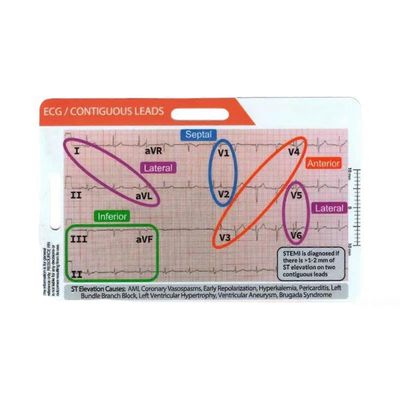 Haloppe EKG / EKG-rytmitaskukortti, kaksipuolinen muotoilu EKG-rytmin tulkintamerkkikortti EKG-nopeuden taskukortit EKG-jarrusatulat sairaanhoitaji...