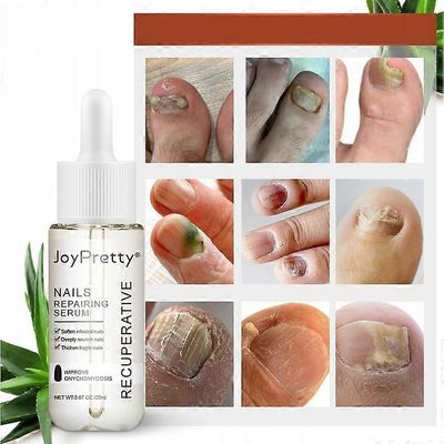 Kynsisieni vahva kynsien korjausneste