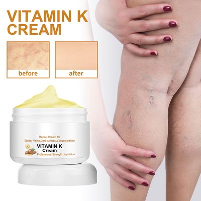 Ofocase Vitamin K Cream, Premium formel for blåmerker, edderkoppårer, mørke sirkler, ødelagte kapillærer, øyne og ansikt 60g
