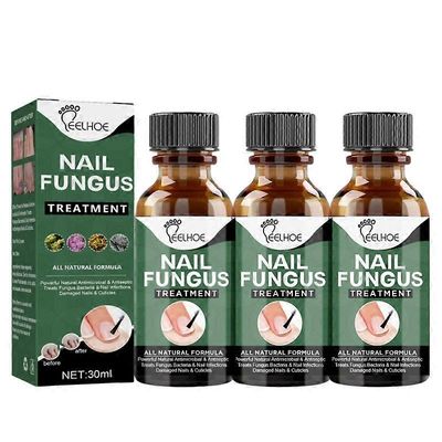 3x Harmaan Kynnen Korjaus Essence Paksunta Tyyppi Harmaan Kynnen Korjaus Essence Kynsien Paksunta Väri Irtoava Pehmeä Kynsi