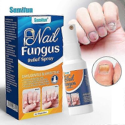 Extra Vahva Kynsisienen Hoito - Tehokas Ratkaisu Sormi- ja Varpaankynsisieneen, Suojaa Paksuja, Katkeilevia, Värjäytyneitä Kynsiä, Palauttaa Värjäy...