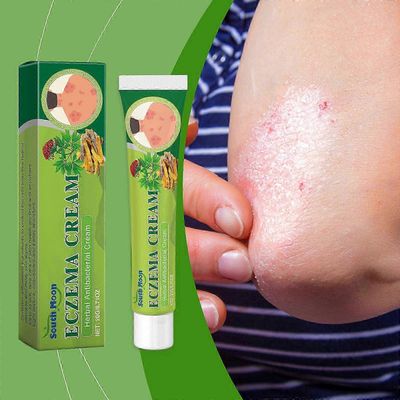 20g kasviperäinen ekseema voide, kasviperäinen psoriaasivoide, anti-inflammatorinen ja bakterisidinen voide, korjaa vaurioitunut ihon este 3 kpl