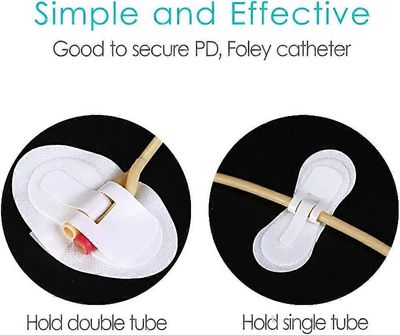 Syöttöletkutyynyt Peg/G/J-putkelle Mahalaukun stabilointiaineen tarvikkeet Vatsa