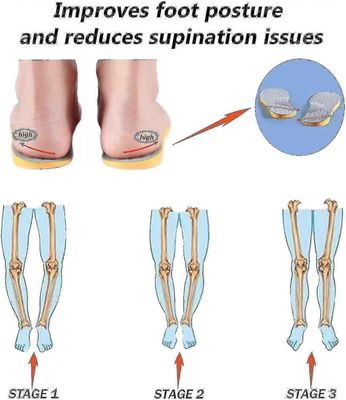 Supinaatiopohjalliset ylisupinaatioon ja korkeaan kaaritukeen, ortoosit jalkojen kohdistukseen, knoc tw 37–38