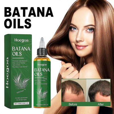 Batanaöljy hiusten kasvuun, 100% puhdas ja luonnollinen raaka batanaöljy, orgaaninen raaka batanaöljy Hondurasista Care for Hair Thickner Longer &;...