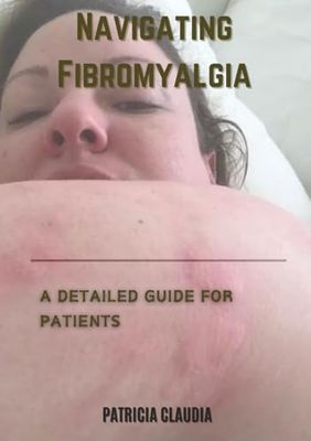 Navigating Fibromyalgia: A Detailed Guide for Patients