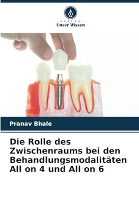 Die Rolle des Zwischenraums bei den Behandlungsmodalitäten All on 4 und All on 6