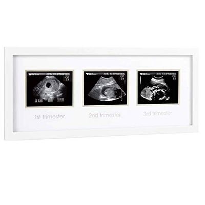 Pearhead P63016 - Estrutura de ultrassom trimestral, sem texto