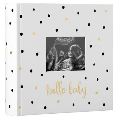 Pearhead Album photo pour bébé, souvenir pour les nouveaux parents et futurs parents, accessoire pour bébé neutre, noir et doré à pois