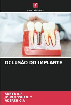 OCLUSÃO DO IMPLANTE