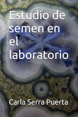 Estudio de semen en el laboratorio