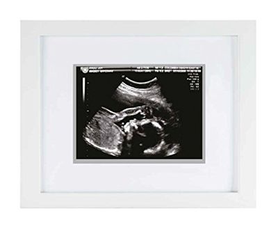 Pearhead P63015 Sonogram erringsframe, wit