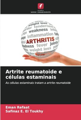 Artrite reumatoide e células estaminais: As células estaminais tratam a artrite reumatoide