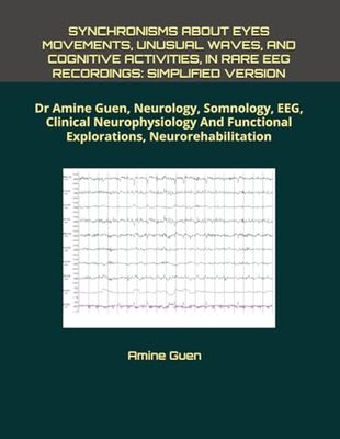 SYNCHRONISMS ABOUT EYES MOVEMENTS, UNUSUAL WAVES, AND COGNITIVE ACTIVITIES, IN RARE EEG RECORDINGS: SIMPLIFIED VERSION: Dr Amine Guen, Neurology, ... Functional Explorations, Neurorehabilitation