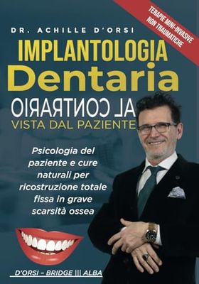 Implantogia Dentaria al Contrario Vista dal Paziente: Psicologia del Paziente e Cure Naturali per la Mancanza dei Denti