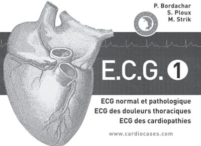 ECG tome 1: ECG normal et pathologique, ECG des douleurs thoraciques, ECG des cardiopathies