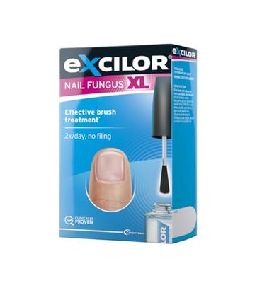 Excilor Nail Fungus Treatment Solution, Fungal Nail Treatment and Repair for Fingernails and Toenails XL 7ml, (Packing May Vary)