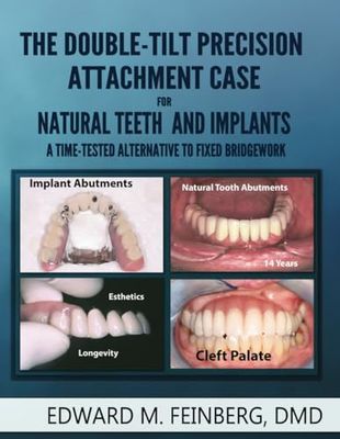 The Double-Tilt Precision Attachment Case for Natural Teeth and Implants