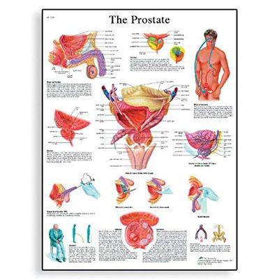 3B Scientific Tablica do nauki The Prostate Gland Diagram