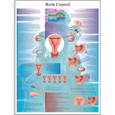3B Scientific Vetenskaplig mänsklig anatomi - diagram för födelsekontroll, pappersversion