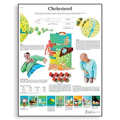3B Scientific Anatomia człowieka - tabela cholesterolu, wersja papierowa