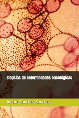 Biopsias de enfermedades oncológicas