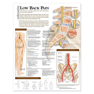 Comprensión del dolor lumbar gráfico anatómico