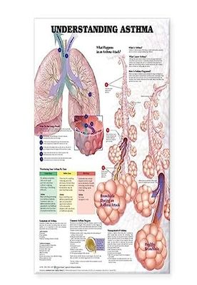 Understanding Asthma - Tabla anatómica