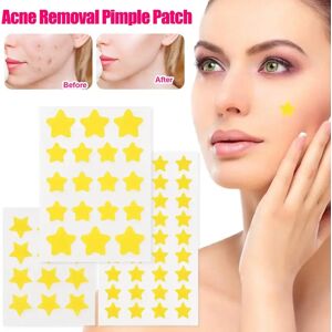 Pimple Patch Acne Concealer Face Spot Coloful Invisible Acne Removal Skin Care Stickers Beauty Acne Tool