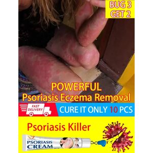 Psoriasis Cream Ointment For Psoriasis Skin Eczema Best Against Psoriasis Treatment Products