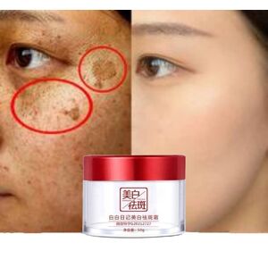 Dark Spot Corrector Skin Whitening Fade Cream Lightening Blemish Removal Serum Reduces Age Spots Freckles Face Cream 50g