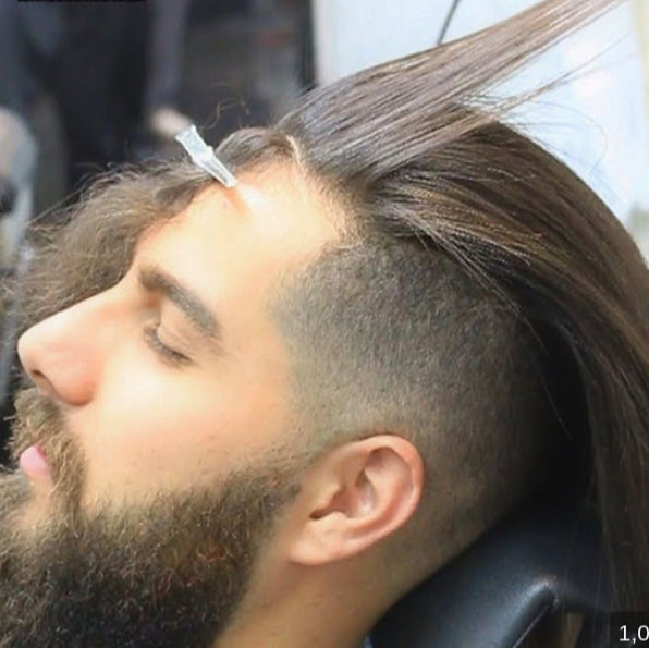 Keratin