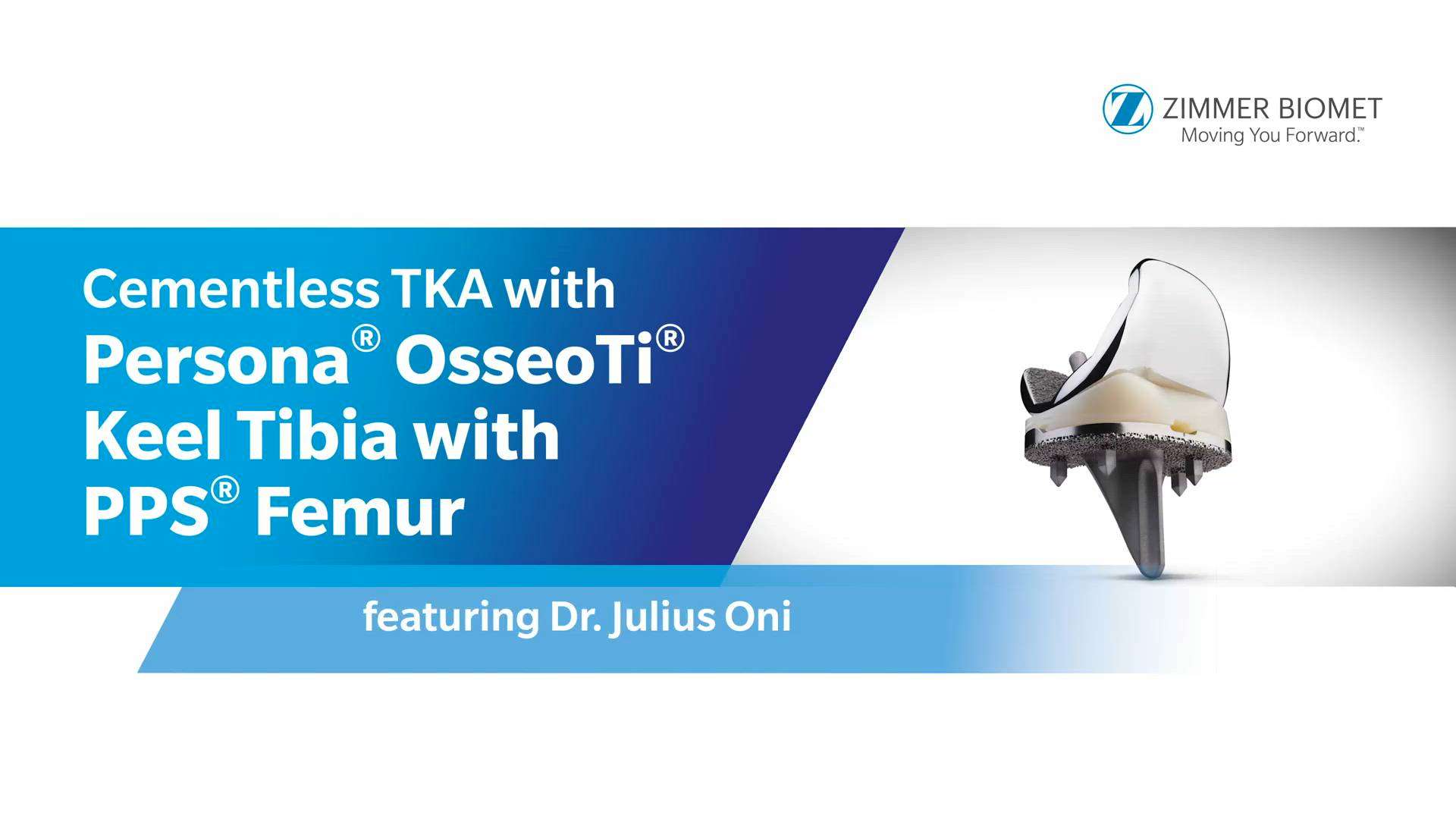 Cementless TKA with Persona® OsseoTi® Keel Tibia with PPS® Femur 