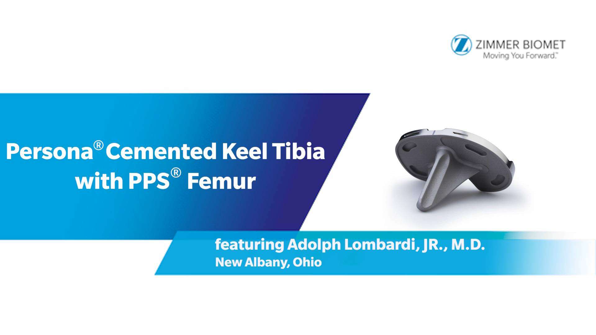 Persona ® Cemented Keel Tibia and PPS ® Femur Dr. Lombardi Persona ® Cemented Keel Tibia and PPS ® Femur Dr. Lombardi