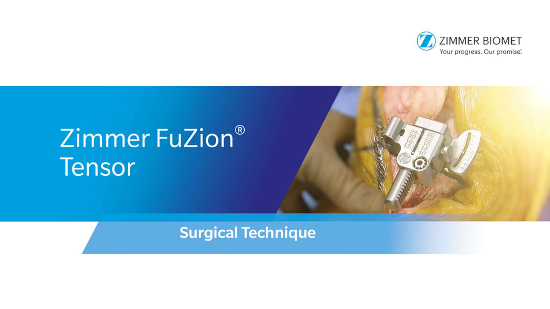 Zimmer FuZion® Tensor Surgical Technique