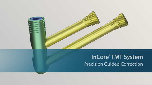 InCore TMT System Surgical Animation