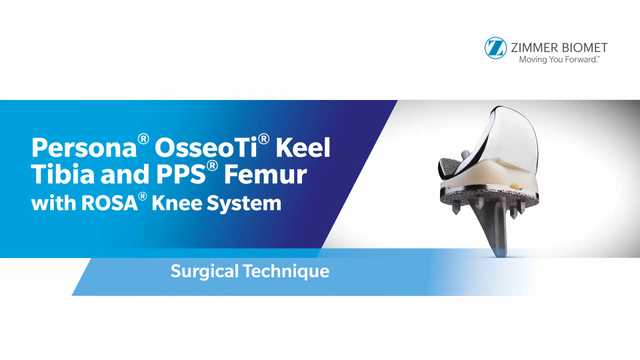 ROSA® Knee System with Persona® OsseoTi® Keel Tibia with Dr. Peter Sculco 