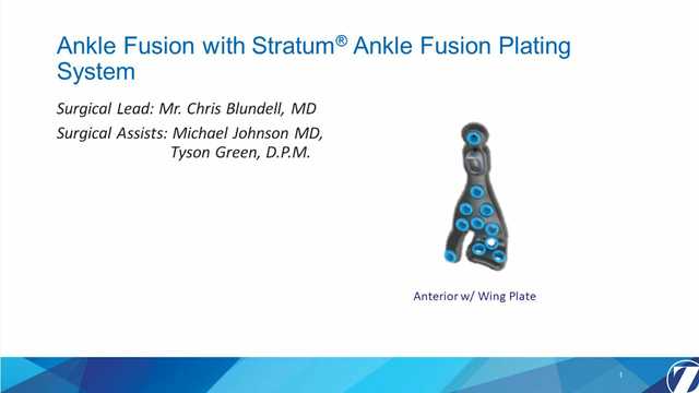 Ankle Fusion with Stratum Ankle Fusion Plating System