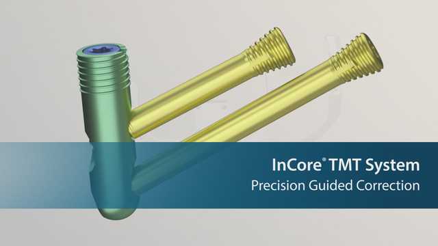 InCore TMT Surgical Technique Animation