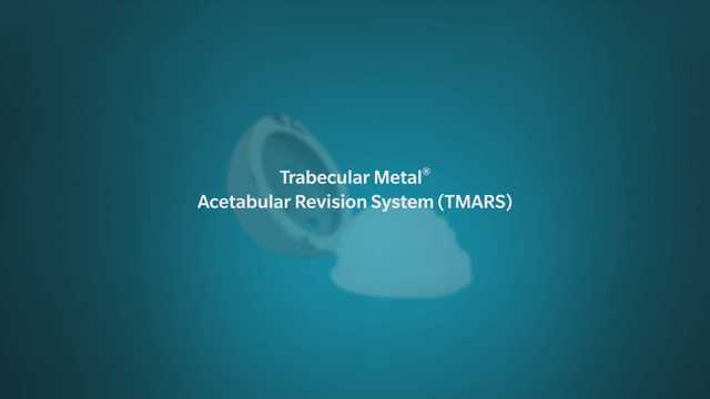 TMARS - Type I & IIa + IIb Bone Defects