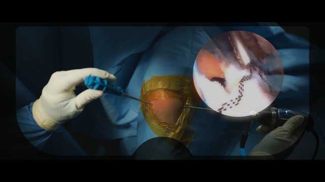 OptiVu™ Streamer Brand Anthem Video