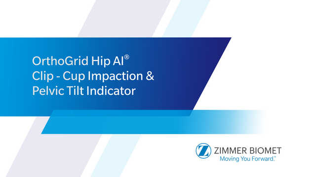 OrthoGrid Hip AI® Clip - Cup Impaction & Pelvic Tilt Indicator 
