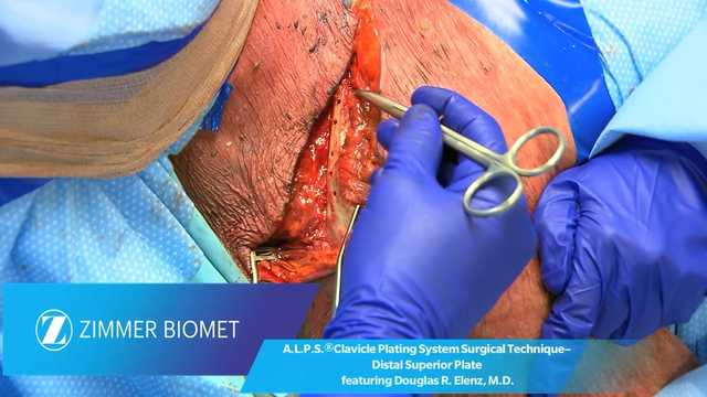 Dr. Elenz Surgical Technique Lateral Base Plate