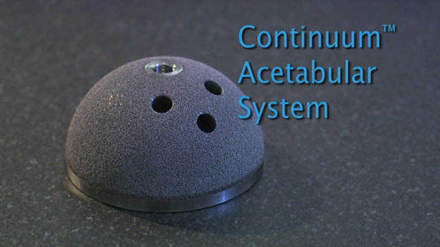 Continuum™ Acetabular System Manufacturing Process