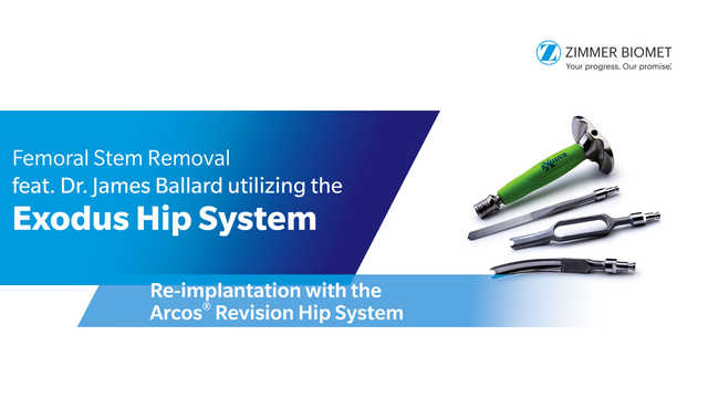 Femoral Stem Removal feat. Dr. James Ballard utilizing the Exodus Hip System - Re-implantation with the Arcos® Revision Hip System