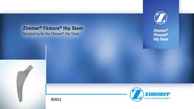 Templating for a Fitmore® Hip Stem