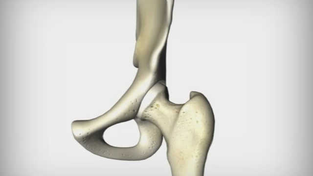 Hip Joint Animation