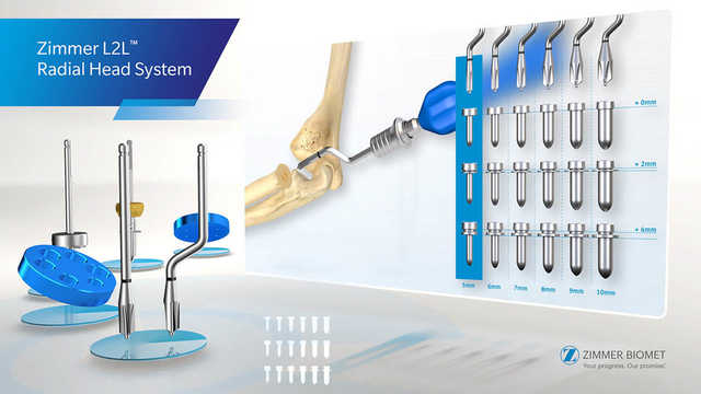 Zimmer  L2L™  Radial Head System Surgical Animation